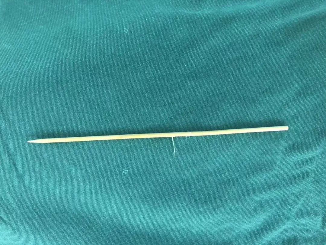 惊心!3岁男孩好可怜 竹签从嘴巴插入脑部 这种流行小吃竟这么危险